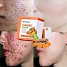 turmeric face soap